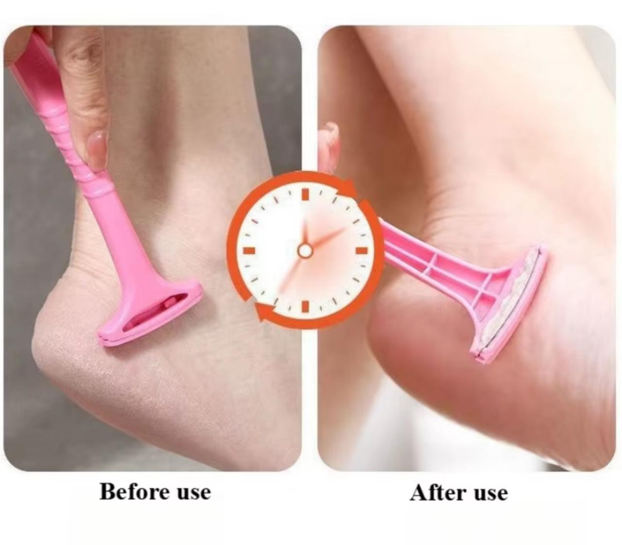 Foot Callus Remover Kit – Heel Scraper & Dead Skin Tool Set