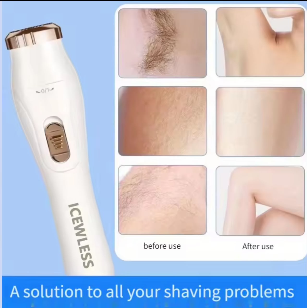 ICEWLESS 3-in-1 Electric Lady Shaver – Body Hair Trimmer, Nose Hair & Bikini Trimmer, USB Rechargeable, Painless